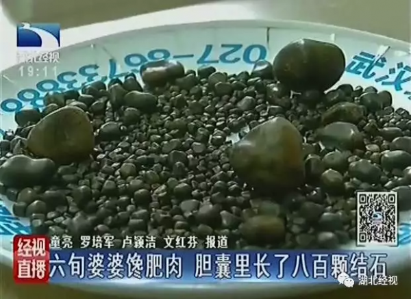 第2张图片