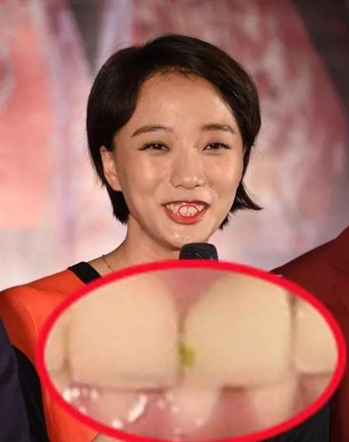第7张图片