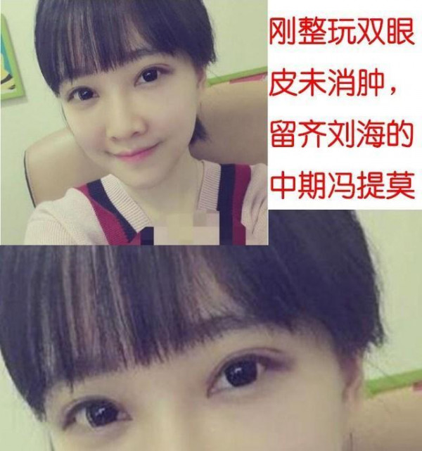 第5张图片