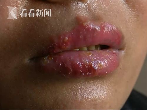 第2张图片