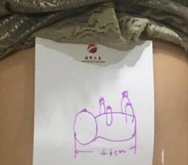 第2张图片