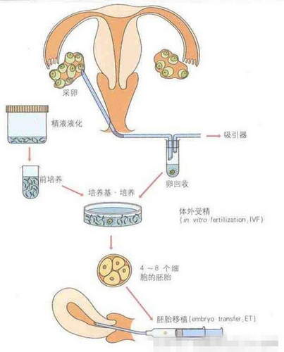 第2张图片