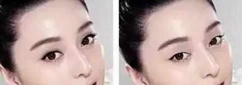 第2张图片
